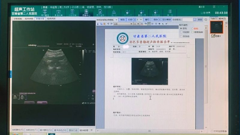 孕前检查十大项目排名